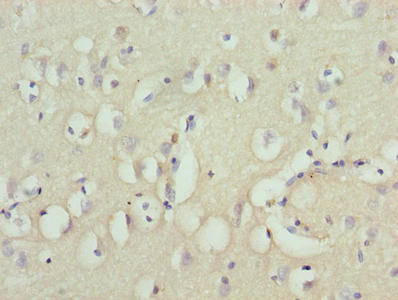 ZNF177 Antibody