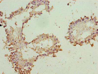 ZNF184 Antibody
