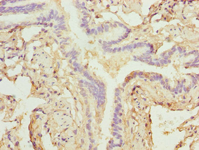 ZNF212 Antibody