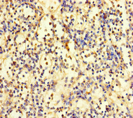ZNF221 Antibody