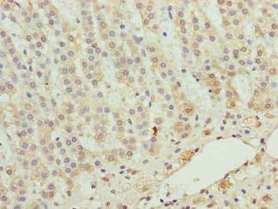 ZNF226 Antibody