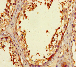ZNF230 Antibody