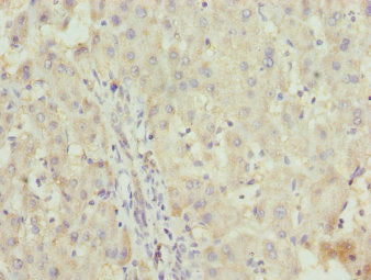 ZNF253 Antibody