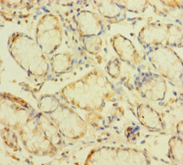 ZNF26 Antibody
