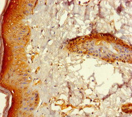 ZNF260 Antibody