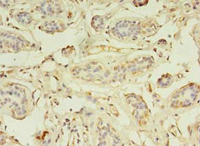 ZNF266 Antibody