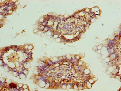 ZNF281 Antibody