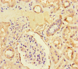 ZNF366 Antibody