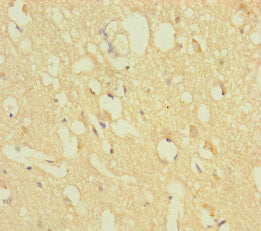 ZNF396 Antibody