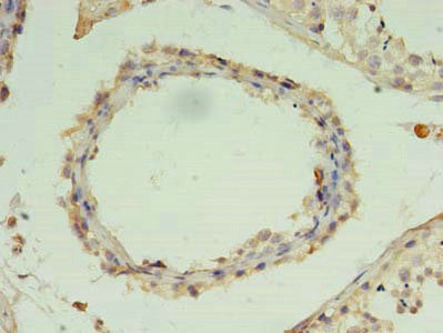 ZNF397 Antibody