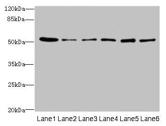ZNF398 Antibody