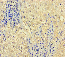 ZNF404 Antibody