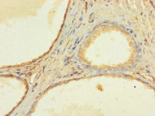 ZNF432 Antibody