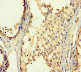 ZNF454 Antibody