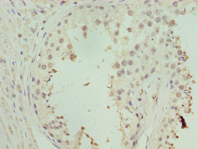 ZNF490 Antibody