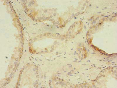 ZNF502 Antibody