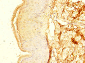ZNF513 Antibody