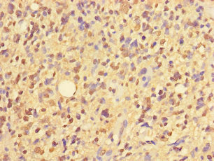 ZNF559 Antibody