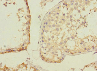 ZNF582 Antibody