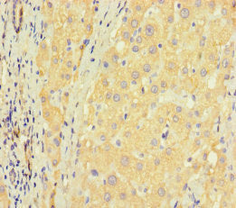 ZNF583 Antibody