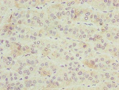 ZNF622 Antibody