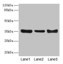ZNF625 Antibody