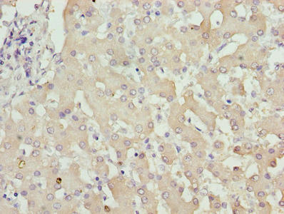 ZFP69B Antibody