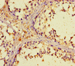 ZNF662 Antibody