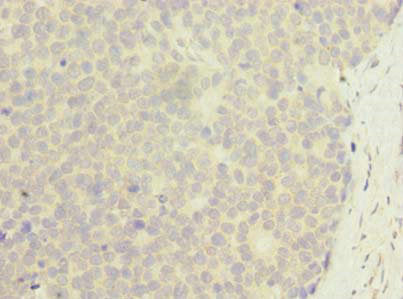 ZNF688 Antibody