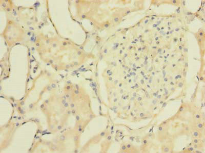 ZNF707 Antibody