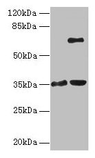 ZNF75A Antibody