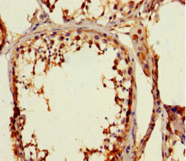 ZNF77 Antibody