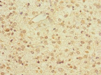 ZNF774 Antibody