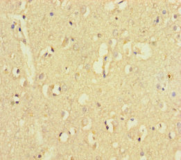ZNF800 Antibody