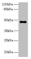 ZNF821 Antibody