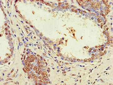 ZNF844 Antibody
