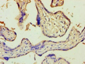 ZRANB2 Antibody