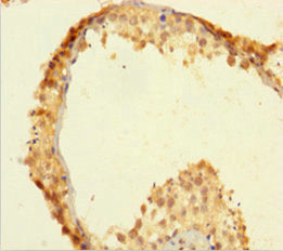 ZSCAN20 Antibody