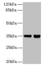 ZBED1 Antibody