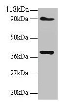 NDUFS5 Antibody