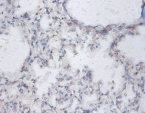 SAT1 Antibody