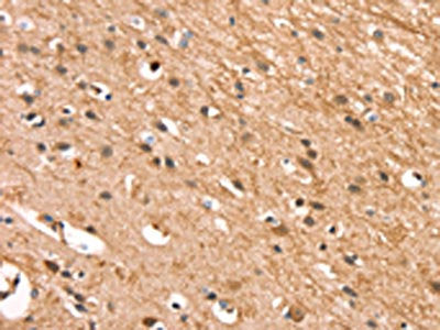 CSTB Antibody