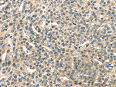 RASA2 Antibody
