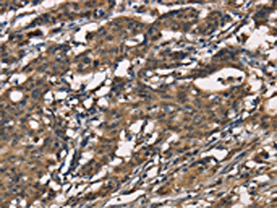 SENP1 Antibody