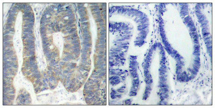 EIF2AK2 (Ab-451) Antibody
