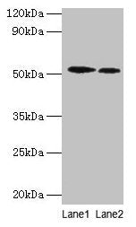 RPS6KB2 Antibody