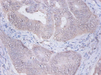 PRKCSH Antibody