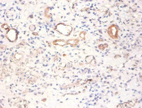 PKM Antibody