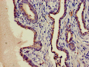 PIM1 Antibody