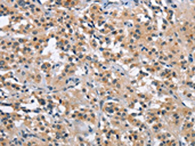 MAPT Antibody